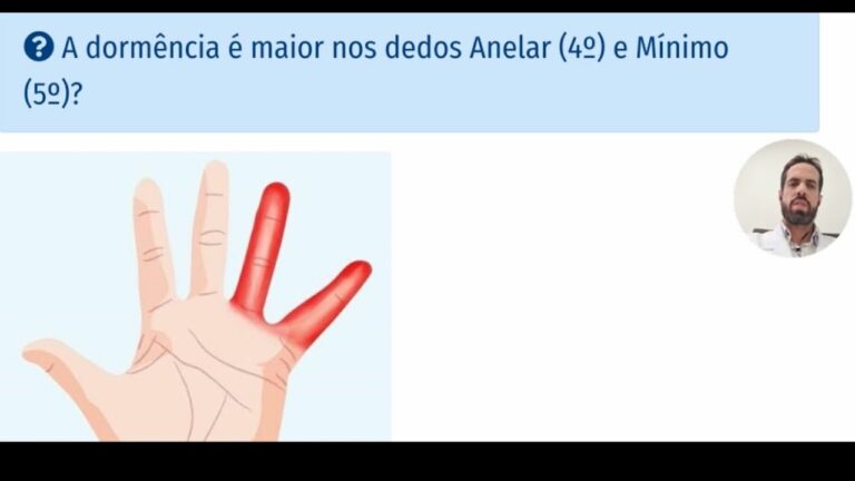 Como Aliviar a Dorm&ecirc;ncia no Dedo da M&atilde;o