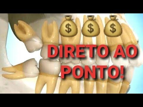 Quanto custa a extra&ccedil;&atilde;o do siso: Guia de Pre&ccedil;os