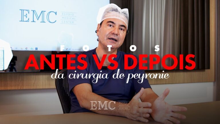 Transforma&ccedil;&atilde;o de Peyronie: Antes e Depois