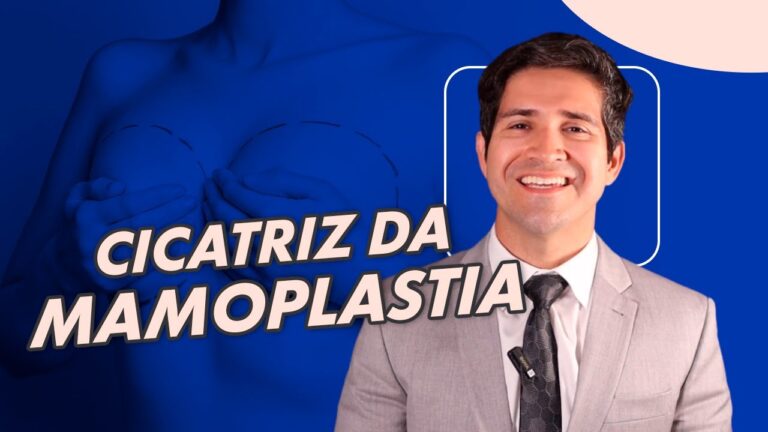 Mamoplastia Cicatrizada: Tudo o que voc&ecirc; precisa saber