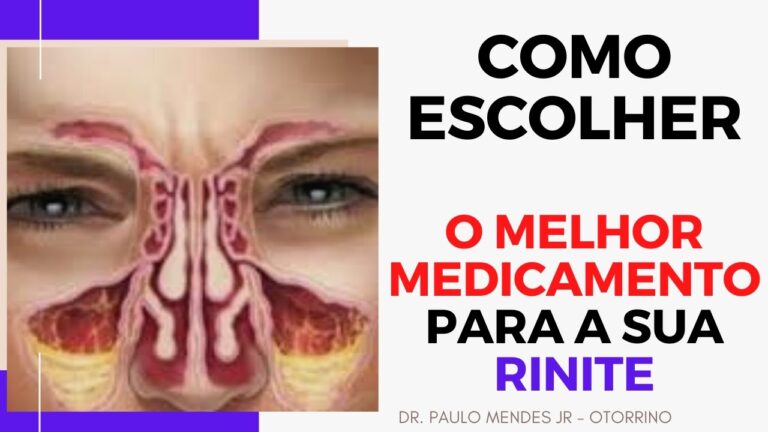Remédio para Rinite Alérgica: Opções e Eficácia