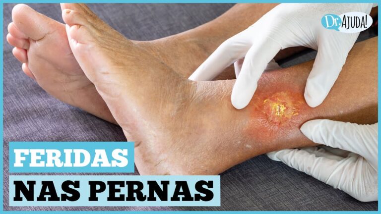 Poss&iacute;veis Causas de um Buraco na Perna