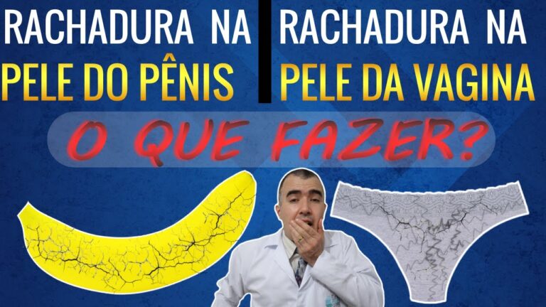 O Significado da Pele Rachada: Explicação e Cuidados