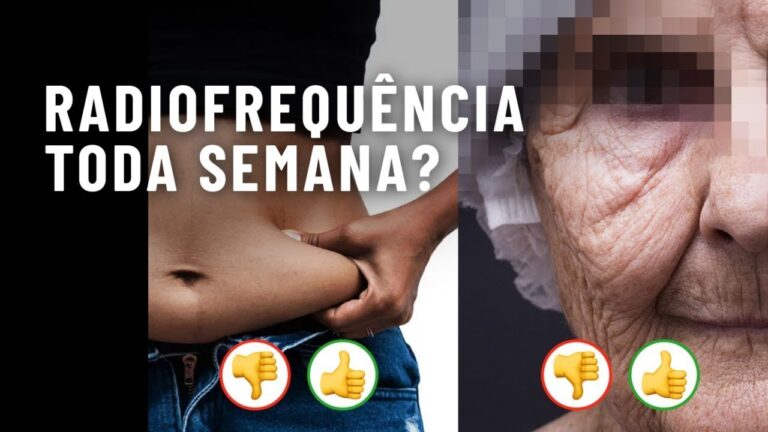 Contraindicações da cavitação e radiofrequência: o que você precisa saber