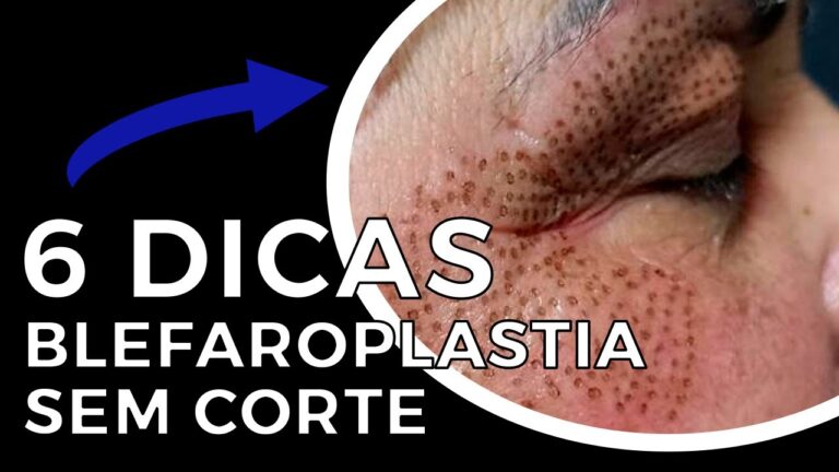 Como remover mancha negra na pálpebra superior