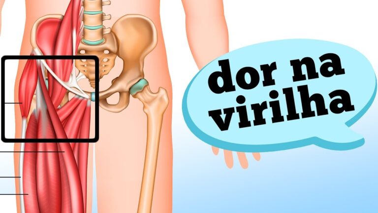 Como aliviar a dor na parte interna da coxa pr&oacute;xima &agrave; virilha