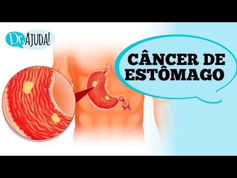 Guia Completo sobre P&aacute;pulas no Est&ocirc;mago