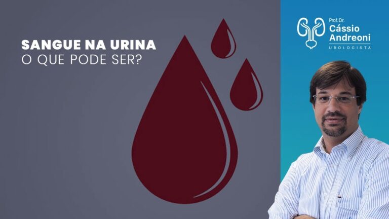 Hemorragia na urina: poss&iacute;veis causas