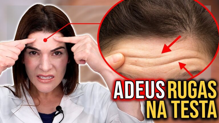Guia para Eliminar Marcas de Express&atilde;o da Testa
