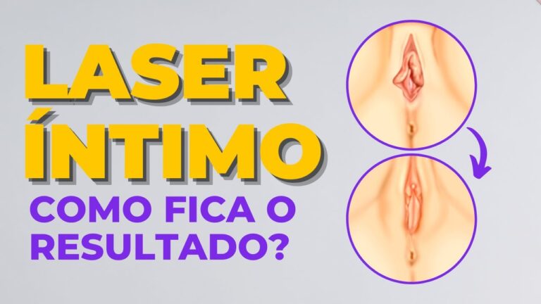 Resultados do Tratamento a Laser &Iacute;ntimo: Antes e Depois