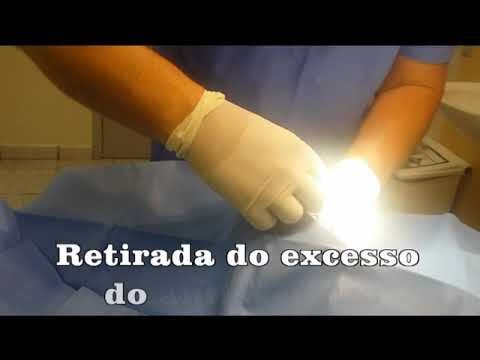 Pre&ccedil;o da cirurgia para unha encravada: tudo que voc&ecirc; precisa saber