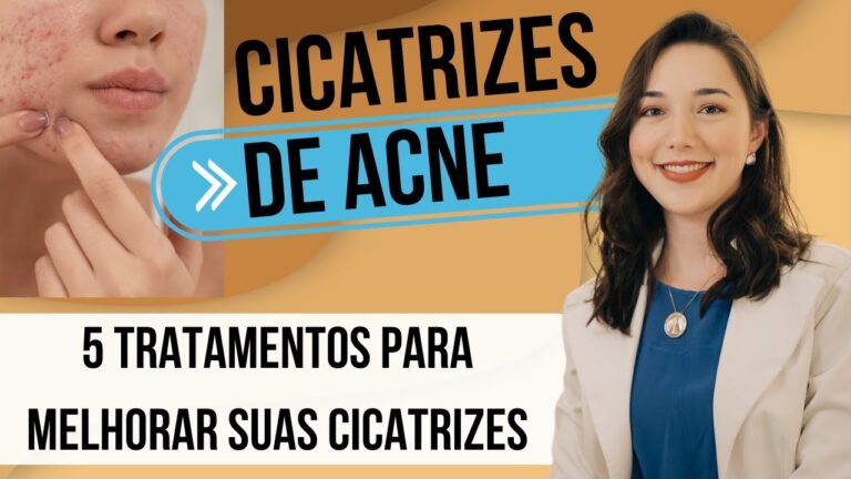 Estrat&eacute;gias Eficazes para Diminuir Cicatrizes de Acne