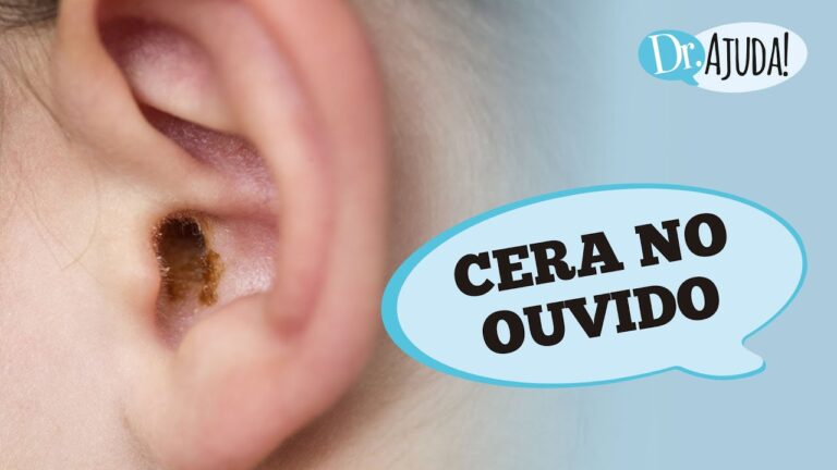 Muita Cera no Ouvido: O Que Pode Ser?