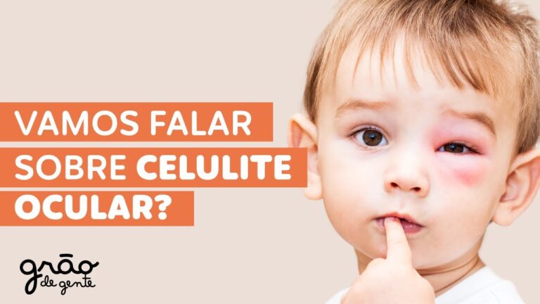 Como tratar celulite no olho: guia completo