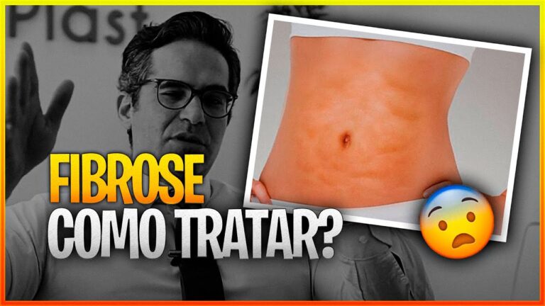 Como Eliminar a Fibrose P&oacute;s-Cir&uacute;rgica