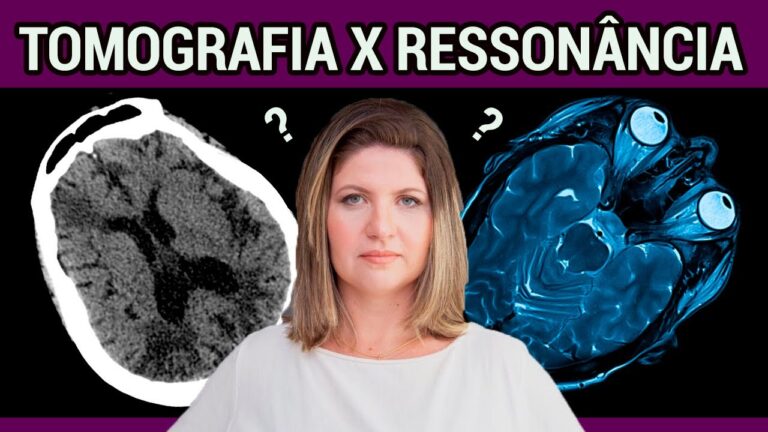 Compara&ccedil;&atilde;o entre Tomografia Computadorizada e Resson&acirc;ncia Magn&eacute;tica