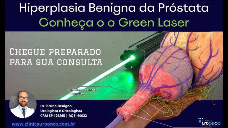 Novo tratamento promissor para hiperplasia benigna da pr&oacute;stata