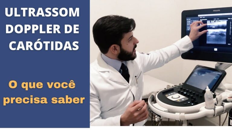 Importância do Doppler dos Vasos do Pescoço na Prevenção de Doenças