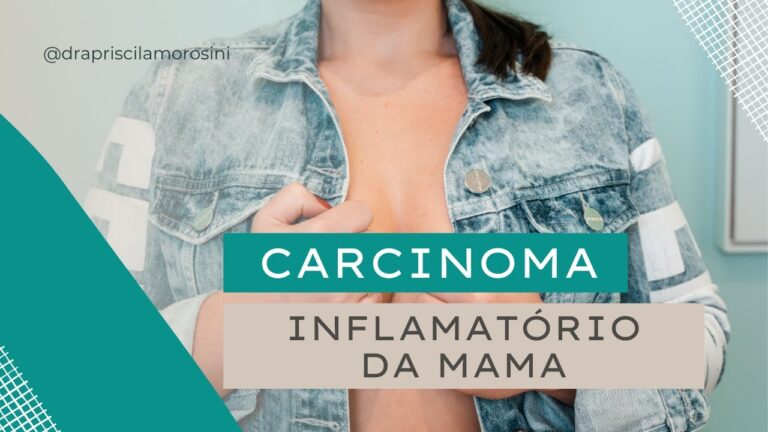 Imagens de Carcinoma Inflamat&oacute;rio da Mama: Guia Visual