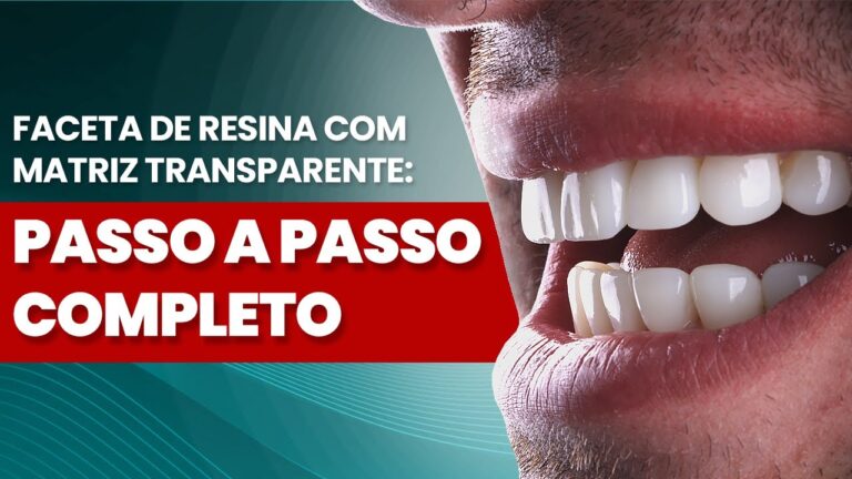 Dente transparente na ponta: causas e tratamentos