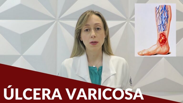 Medico Especialista em Ulceras Varicosas: Tratamento Eficaz