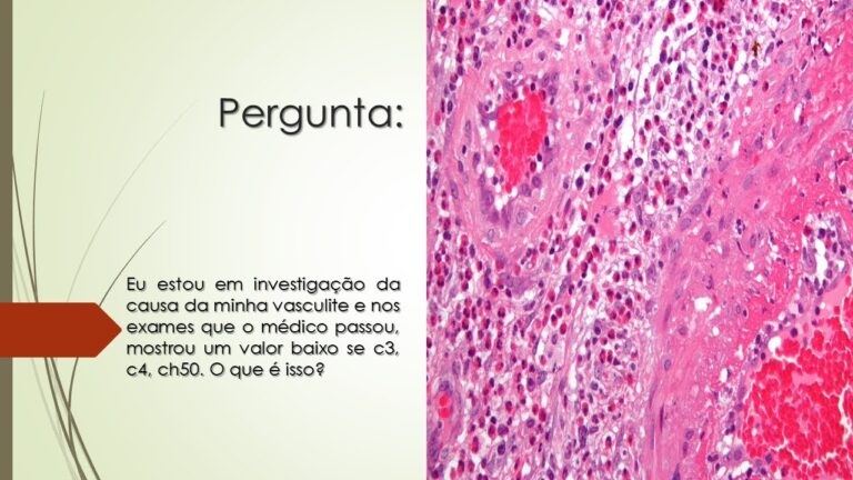 Complemento C4 Alto: O que Significa?