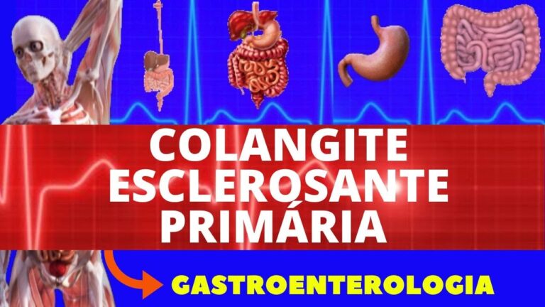Principais Causas de Dilata&ccedil;&atilde;o das Vias Biliares