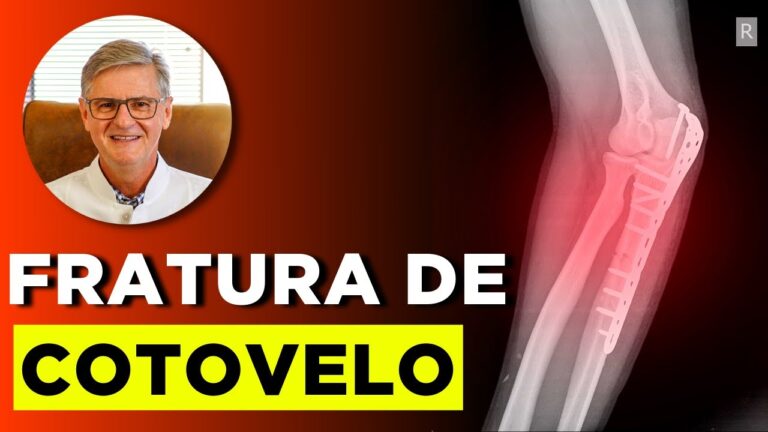 Tempo de Recupera&ccedil;&atilde;o de Fratura de Cotovelo: O que Esperar?