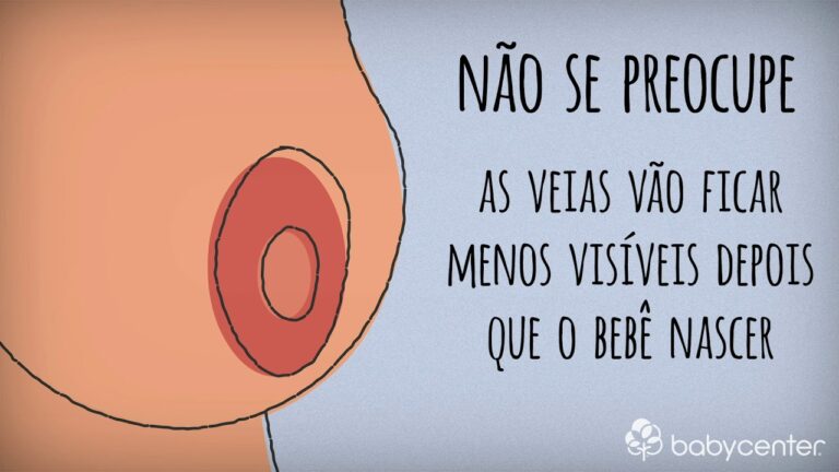 Aureola Inchada na Gravidez: Causas e Tratamentos