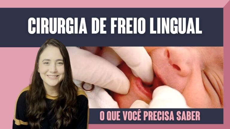 Os Riscos de Cortar o Freio da Língua em Recém-Nascidos