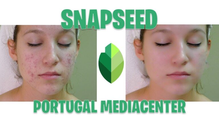 5 Dicas Infal&iacute;veis para Eliminar as Borbulhas da Cara