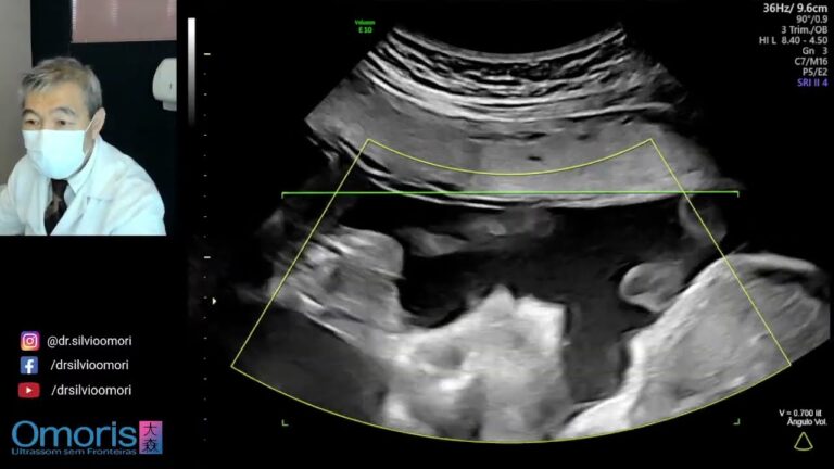 Desenvolvimento fetal &agrave;s 23 semanas: o que esperar