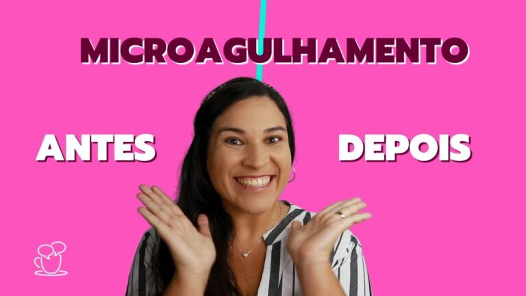 Transformação do Rosto com Microagulhamento: Antes e Depois