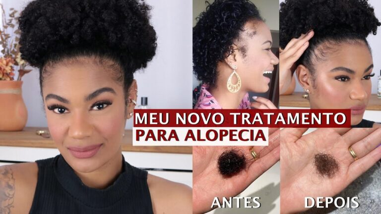 Betnovate Capilar: O Segredo para Cabelos Mais Longos e Fortes