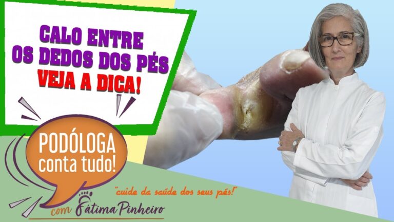 Tratamento eficaz para calos nos dedos dos pés