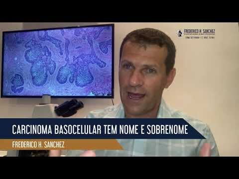 Carcinoma Basocelular Esclerodermiforme: Caracter&iacute;sticas e Tratamento