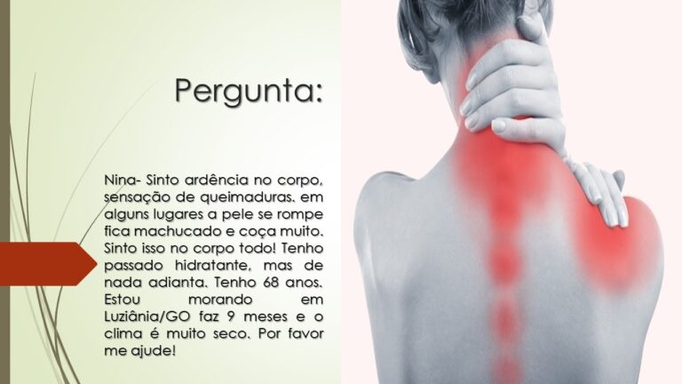 Como Aliviar a Dor na Pele e a Sensa&ccedil;&atilde;o de Queimadura: Guia Completo