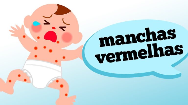 Manchas Vermelhas na Pele: Causas e Tratamentos Sem Coceira ou Dor