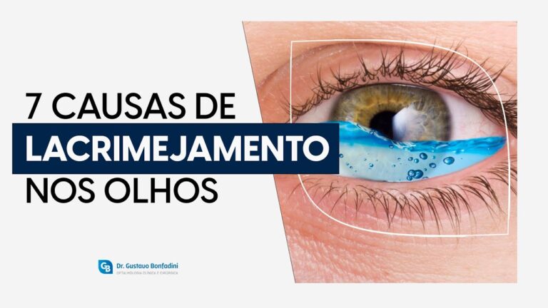 Olhos Sempre a Chorar: Causas e Tratamentos