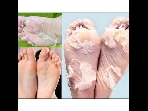 Como Evitar a Pele dos P&eacute;s Descascando: Dicas Simples e Eficientes