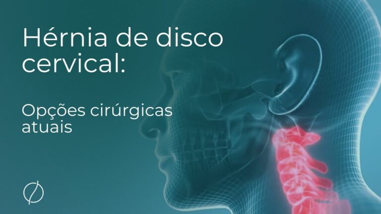 Cirurgia da coluna cervical pelo pesco&ccedil;o: tudo o que voc&ecirc; precisa saber