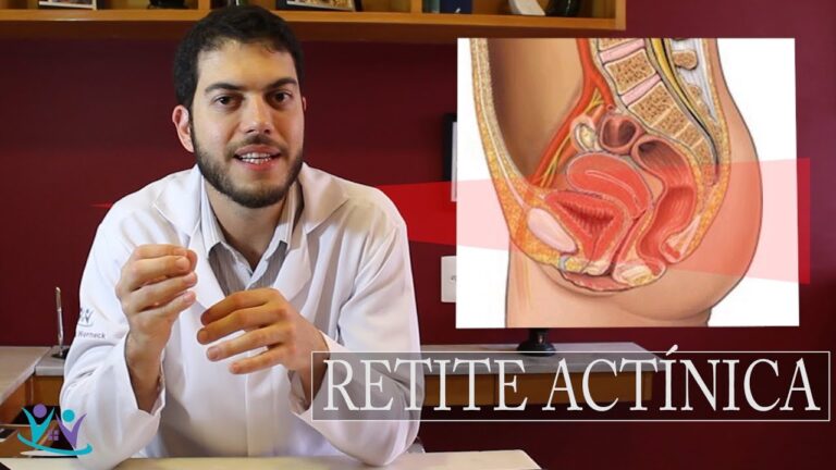 Proctite R&aacute;dica: Causas, Sintomas e Tratamentos Eficazes