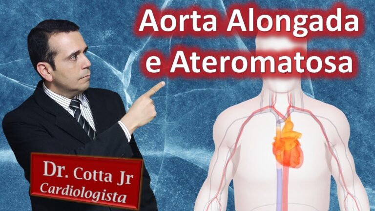 Aorta Alongada: Causas, Sintomas e Tratamento