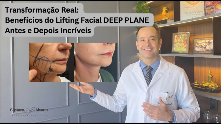 Transforma&ccedil;&atilde;o Facial: Resultados do Lifting de Face e Pesco&ccedil;o