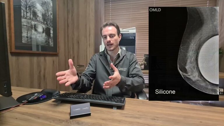 Entendendo o BI-RADS 2: O Que Significa?
