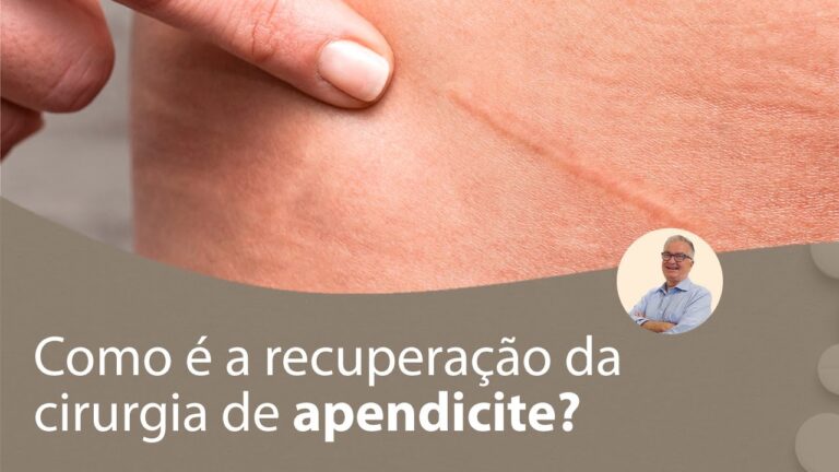 Tempo de Recupera&ccedil;&atilde;o na Cirurgia de Apendicite