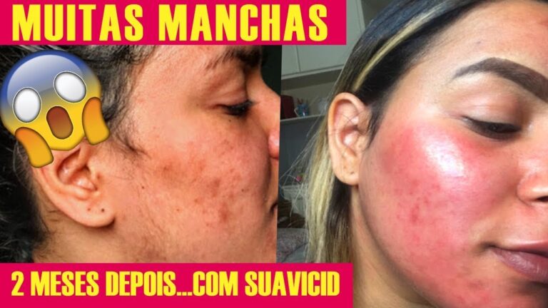 Onde Comprar Suavicid em Portugal: Guia Completo