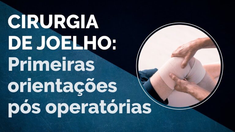 Tempo de Recupera&ccedil;&atilde;o ap&oacute;s Opera&ccedil;&atilde;o no Joelho: O que Esperar