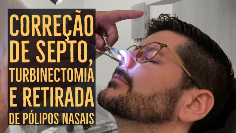 Melhore sua Respira&ccedil;&atilde;o com uma Cirurgia no Nariz
