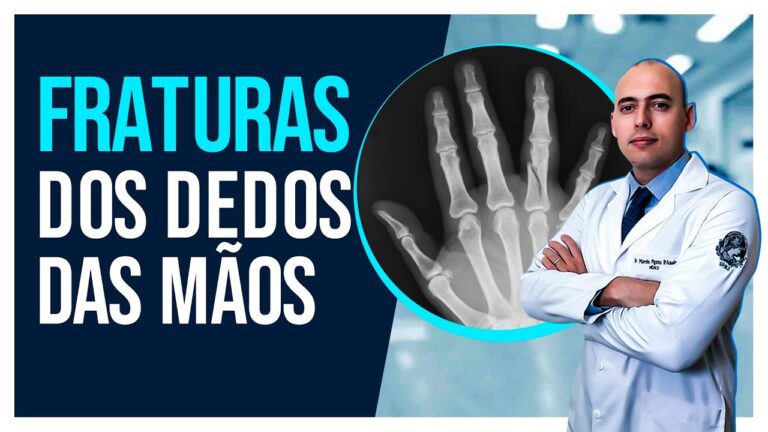 Sintomas de fratura no dedo da m&atilde;o